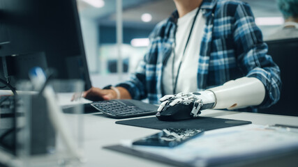 Diverse Office: Person with Disability Using Prosthetic Arm to Work on Computer. Professional with Advanced Thought Controlled Body Powered Myoelectric Bionic Limb to Control Mouse. Focus on Hands - obrazy, fototapety, plakaty