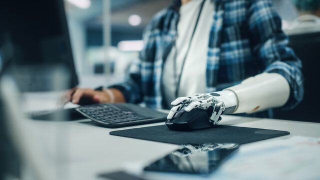 Inclusive Office: Person with Disability Using Prosthetic Arm to Work on Computer. Professional with Advanced Thought Controlled Body Powered Myoelectric Bionic Limb to Control Mouse. Focus on Hands