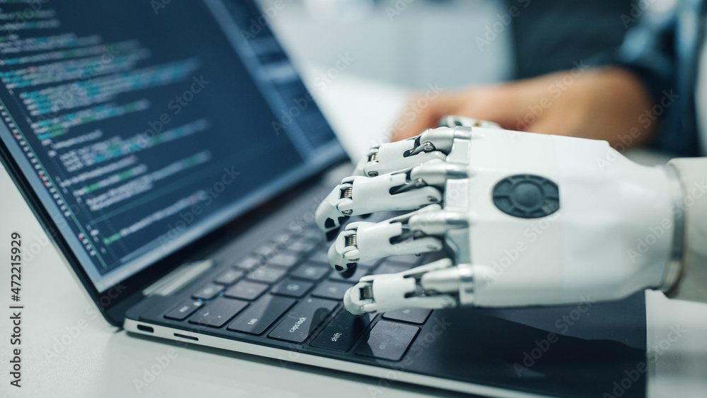 Poster Close-up on Hands: Programmer With Disability Using Prosthetic Arm to Work on Laptop Computer. Specialist Swift and Natural Use of Myoelectric Bionic Hand To Type Code for Software