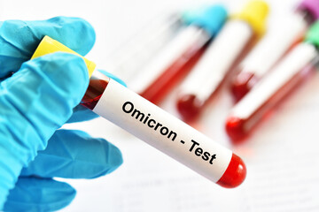 Blood sample tube for Omicron or B.1.1.529 variant of COVID-19 coronavirus test