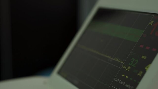 Electronic Cardiotocography Machine Monitoring Fetal Heart Contractions Of Uterus. Printing Cardiogram Report Coming Out Electrocardiogram In Labor Ward During Pregnancy. Medical Diagnostic Equipment