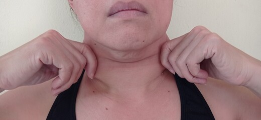 Under the chin of a woman has sagging skin.