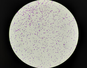 Bacteria Enterococcus isolated on white background micrograph. Gram-positive cocci which cause...