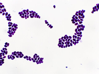 Culture colonies gram stained Microscopic 100x show Candida spp, fungi, emerging multidrug fungus....