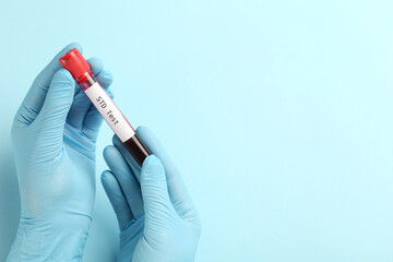 Scientist holding tube with blood sample and label STD Test on light blue background, top view. Space for text