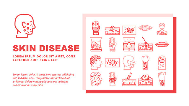 Skin Disease Human Health Problem Landing Web Page Header Banner Template Vector Phytophotodermatitis And Psoriasis, Atopic Dermatitis And Angioma, Hypertrichosis And Angiokeratoma Illustration