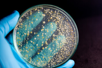 Backgrounds of Characteristics and Different shaped Colony of Bacteria and Mold growing on agar plates from Soil samples for education in Microbiology laboratory.

