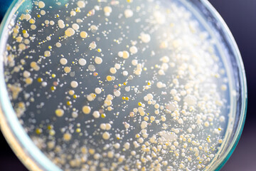 Backgrounds of Characteristics and Different shaped Colony of Bacteria and Mold growing on agar...