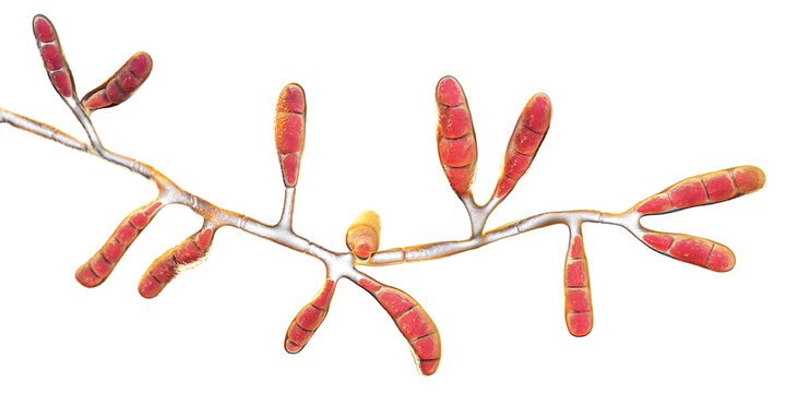 Microscopic fungi Epidermophyton floccosum, scientific illustration