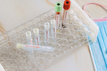 Tube containing swab sample for coronavirus new mutation Omicron COVID-19 test in laboratory
