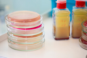Bacterial colonies of streptococci with alpha hemolytics on a blood agar plate. Infection laboratory at the hospital.