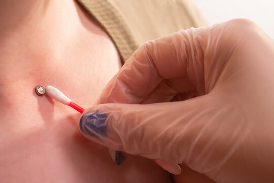 Operation to install microdermal piercing. Professional placing