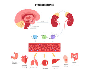 Stress responce system - 472510700