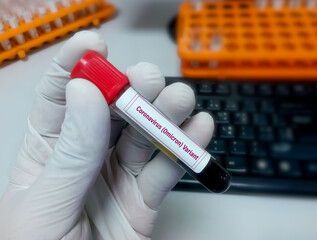 Molecular biologist hold blood sample for Coronavirus Omicron Variant test. Omicron b.1.1.529....
