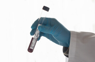 hand holding a sample tube containing omicron virus 