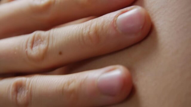 Moles on body dermatology man closeup