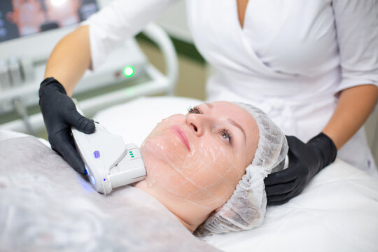 A woman in a cosmetology office receives a SMAS lifting procedure. Non-surgical ultrasound facelift, rejuvenation, moisturizing, getting rid of wrinkles, skin tone and elasticity