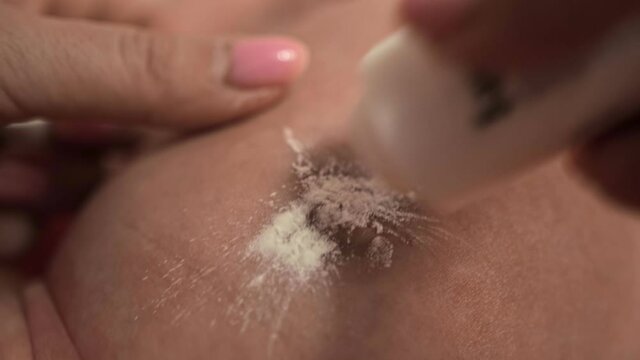 Mother treats newborn's navel with antibacterial powder. Nurse cleans baby's bellybutton with antimicrobial substance. Umbilicus of infant. Care hygiene for white 1 month suckling. Pediatrician. Body