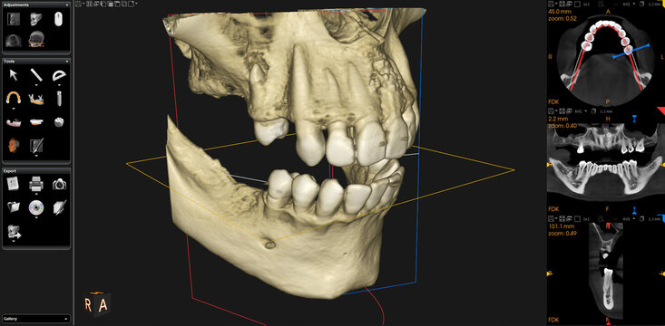 Dental CBCT image