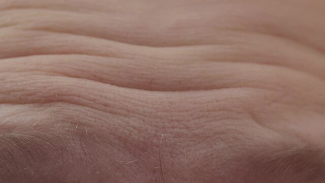 skin wrinkles and folds on the forehead. Facial expression, macro