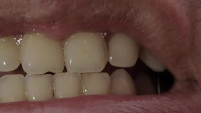 Opening and closing the jaw with teeth. Dental jaw malocclusion concept, macro. Jaw bite