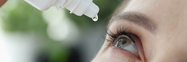 Woman dripping into her eyes with antibacterial drops closeup