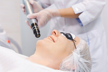 Photo of the face of a young girl wearing protective glasses during a carbon peeling procedure in a beauty salon