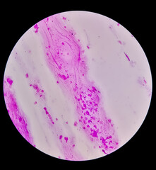 Gram staining, also called Gram's method, is a method of differentiating bacterial species into two...