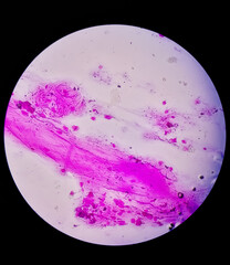 Gram staining, also called Gram's method, is a method of differentiating bacterial species into two...