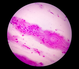 Gram staining, also called Gram's method, is a method of differentiating bacterial species into two large groups (Gram-positive and Gram-negative).