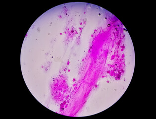 Gram staining, also called Gram's method, is a method of differentiating bacterial species into two...