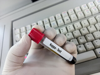 Blood sample for Kappa test, help to detect, diagnose, and monitor conditions associated with an increased production of free light chains.