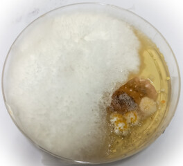 Fungus culture, Trichophyton spp, on Sabouraud dextrose agar (SDA), 21 day incubated at 28-30 °C