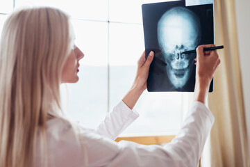 Woman doctor examines x-ray of human skull
