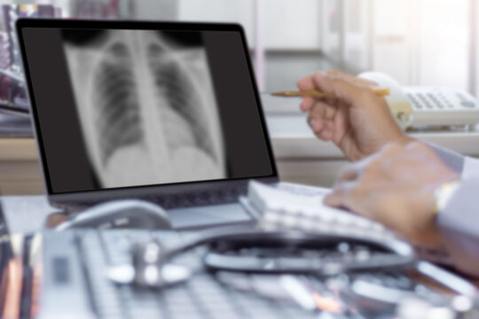 Blurred image of doctor work on laptop computer with chest x-ray film (CXR ) on screen at office medical clinic or hospital. 