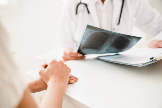 Cropped close up image of doctor talking with patient about health condition, showing x-ray photo, explaining diagnosis at hospital appointment