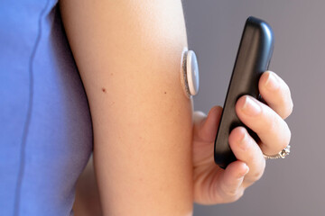 Female hand with continuous glucose monitor showing glucose level