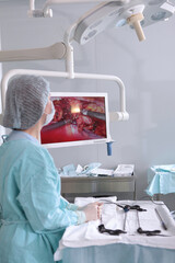 The nurse looks at the monitor during the operation. Back view.Laparoscopic surgery. Medical...