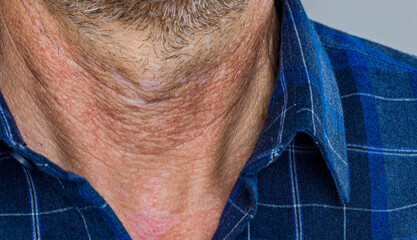 old mans neck close-up