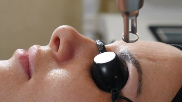 Laser eyebrow tattooing removing. Permanent make-up and tattoos removal. Getting rid of permanent makeup in salon. Female client getting eyebrows tattoo correction. picosecond laser device. 4 k video