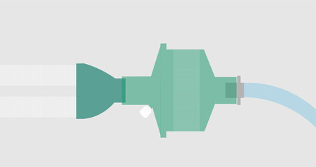 HME filter illustration. Connection the patient circuit, HME filter and endotracheal tube.