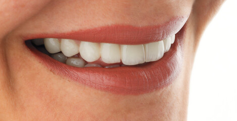 Obraz premium Smile design with zirconia crowns.