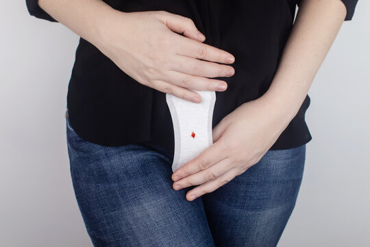 Hypomenorrhea. The woman shows a gynecological pad with a small drop of blood on it. Concept of small amounts during scanty menstruation. Complaints of pain and strange cycle. Diseases in gynecology