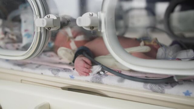 operations of newborn, little baby lies in modern life-preserving cell connected to the operating system in medical ward, close-up