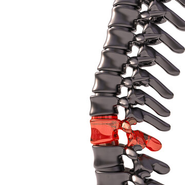 spine with glass vertebrae. fragility concept.