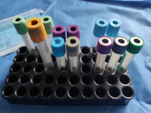 Tubos de muestra de laboratorio