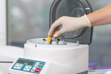 Medical centrifuge. Scientist loading a sample to centrifuge machine in the medical or scientific laboratory