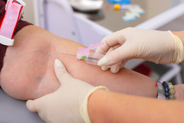 Nurse in white gloves is going to draw blood from vein woman for analysis