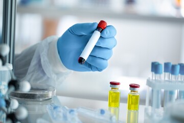 Scientist hold blood sample tube for A covid-19 vaccine. Doctor's hand holds a bottle with a coronavirus vaccine test. Delta, Alpha, Gamma, Variants of Concern.