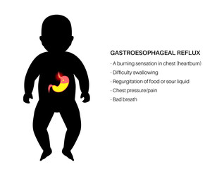GERD in infant body